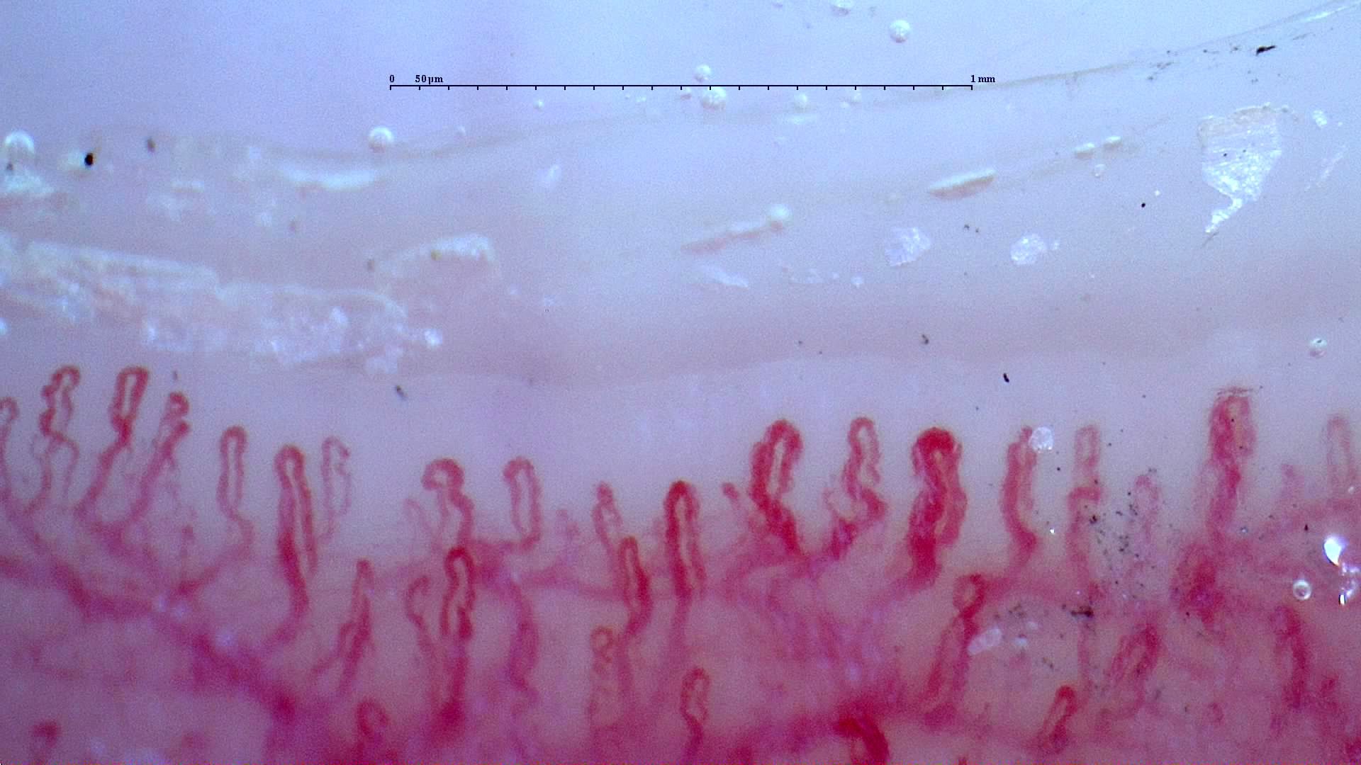 Numerous short tortuous capillaries, with thicker loops near the center-right and a visible deeper vascular network.