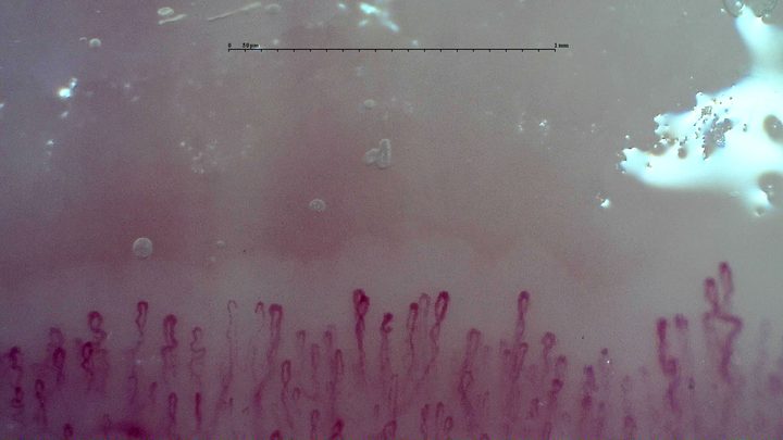 Small coiled capillary apices with occasional wider loops. A larger angulated capillary is visible at the far right.