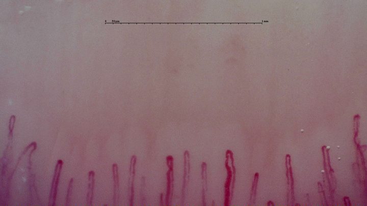 A broad curved capillary right of center, with finer upright loops nearby. Only a narrow part of the capillary row is visible.