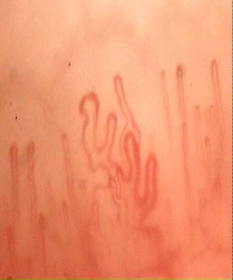 A folded central capillary with a possible accessory loop, between two taller slender hairpins.
