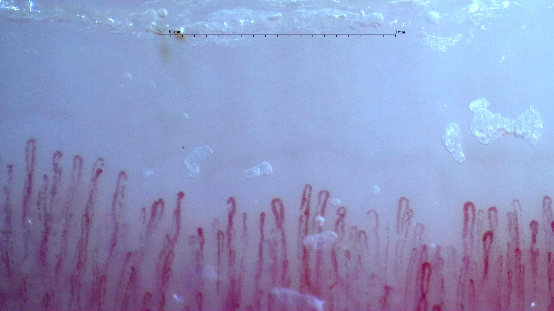Fine elongated capillaries with occasional bends. Surface flakes and bubbles obscure parts of some limbs.