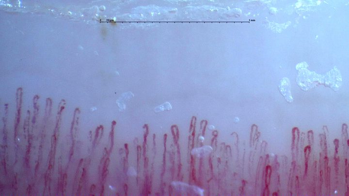 Fine elongated capillaries with occasional bends. Surface flakes and bubbles obscure parts of some limbs.