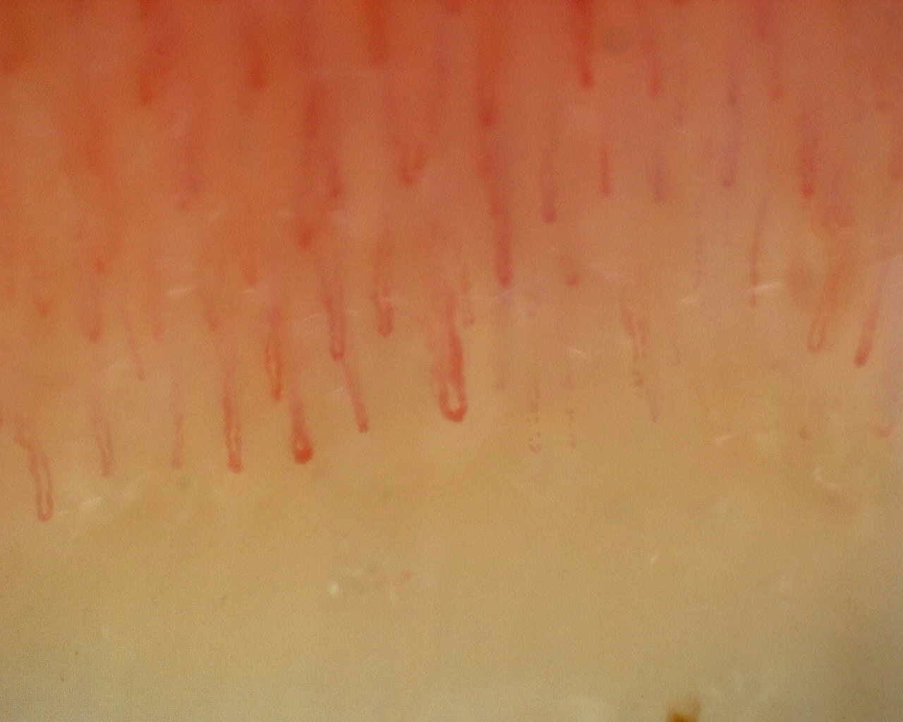 Nailfold capillaroscopy: right index finger, field a. Non-Specific Pattern: Representative Case.
