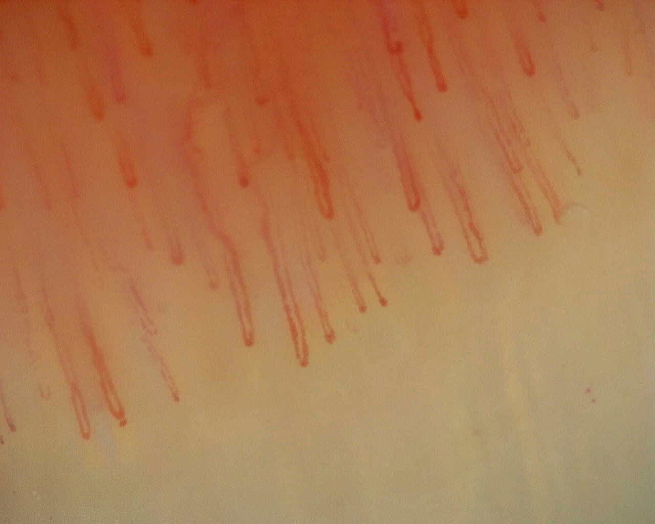 Nailfold capillaroscopy: left ring finger, field b. Non-Specific Pattern: Representative Case.