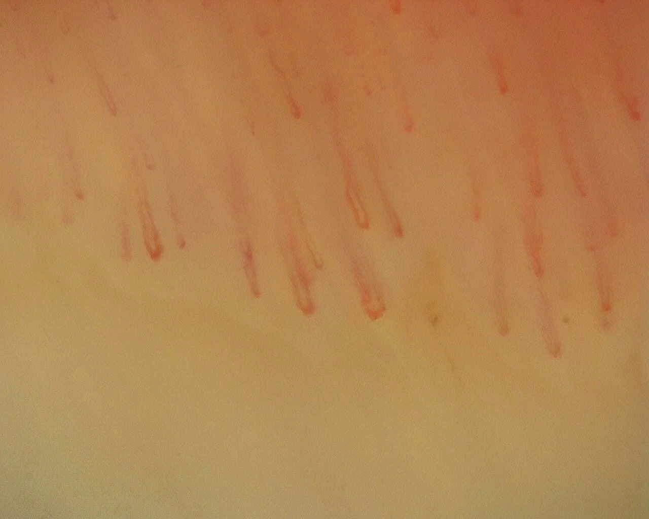 Nailfold capillaroscopy: right middle finger, field a. Non-Specific Pattern: Representative Case.