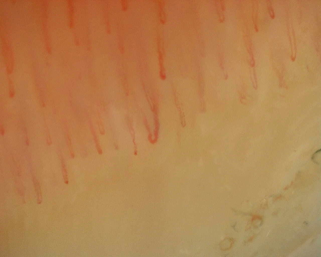 Nailfold capillaroscopy: right index finger, field d. Non-Specific Pattern: Representative Case.