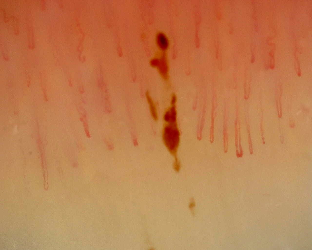 Nailfold capillaroscopy: left index finger, field b. Non-Specific Pattern: Representative Case.
