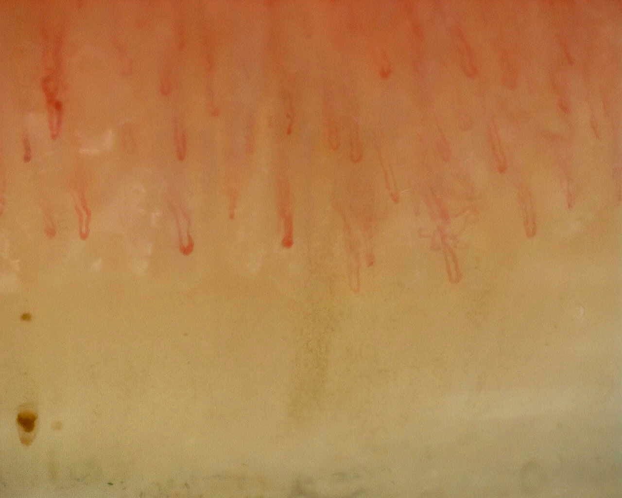 Nailfold capillaroscopy: right index finger, field b. Non-Specific Pattern: Representative Case.