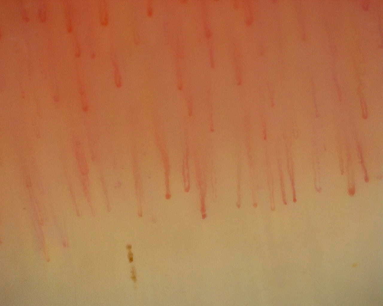 Nailfold capillaroscopy: left middle finger, field b. Non-Specific Pattern: Representative Case.