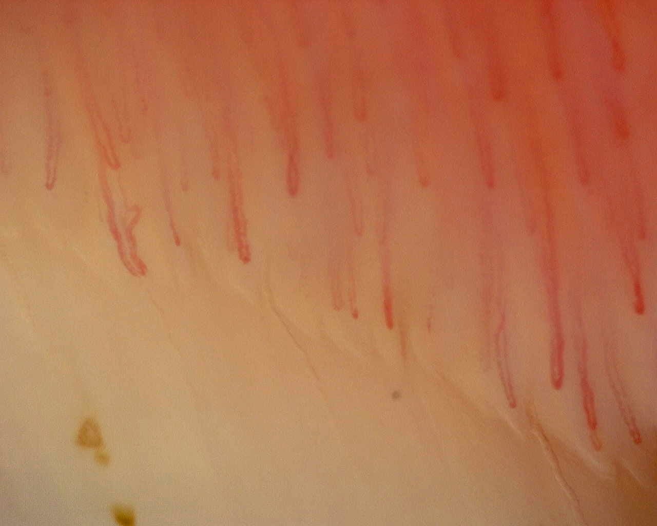 Nailfold capillaroscopy: right little finger, field a. Non-Specific Pattern: Representative Case.