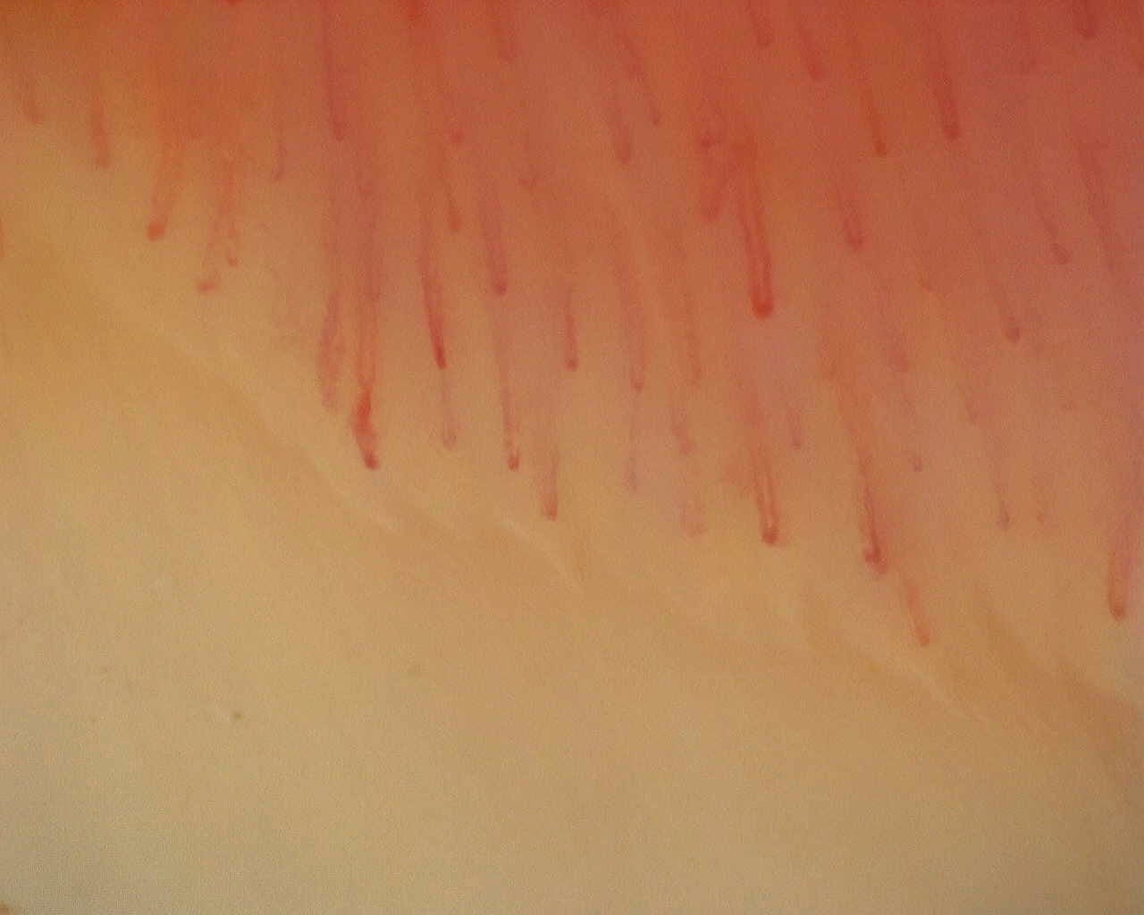 Nailfold capillaroscopy: left ring finger, field d. Non-Specific Pattern: Representative Case.