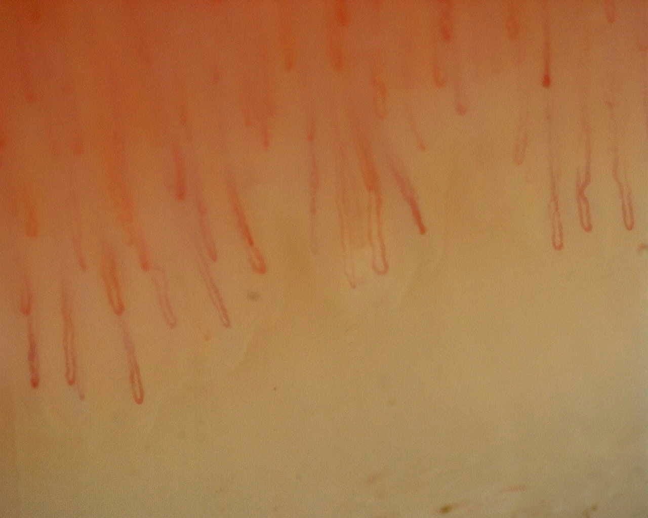 Nailfold capillaroscopy: left index finger, field a. Non-Specific Pattern: Representative Case.