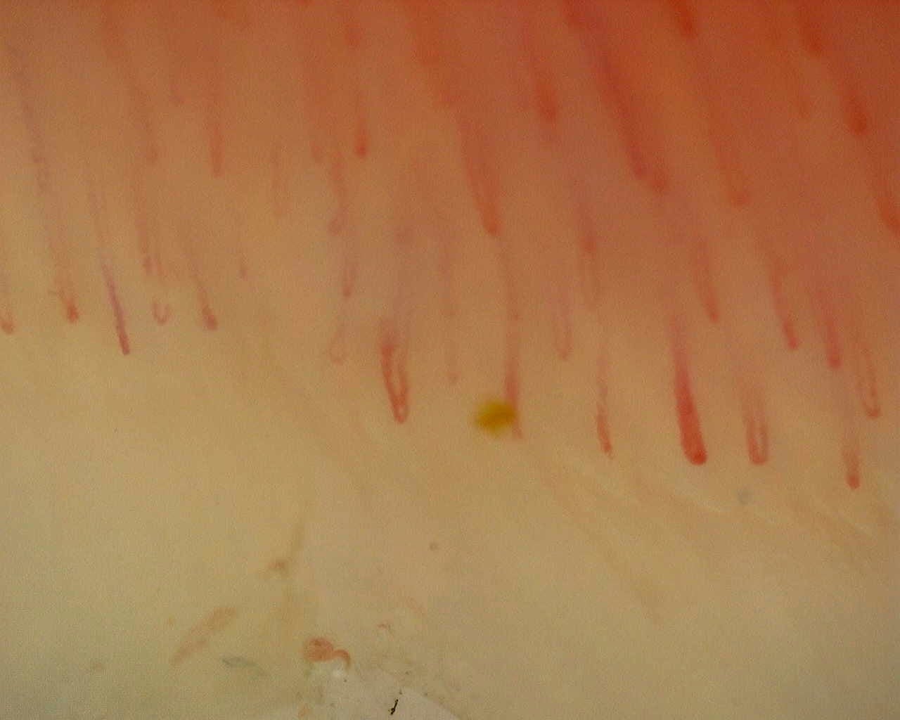 Nailfold capillaroscopy: right ring finger, field a. Non-Specific Pattern: Representative Case.