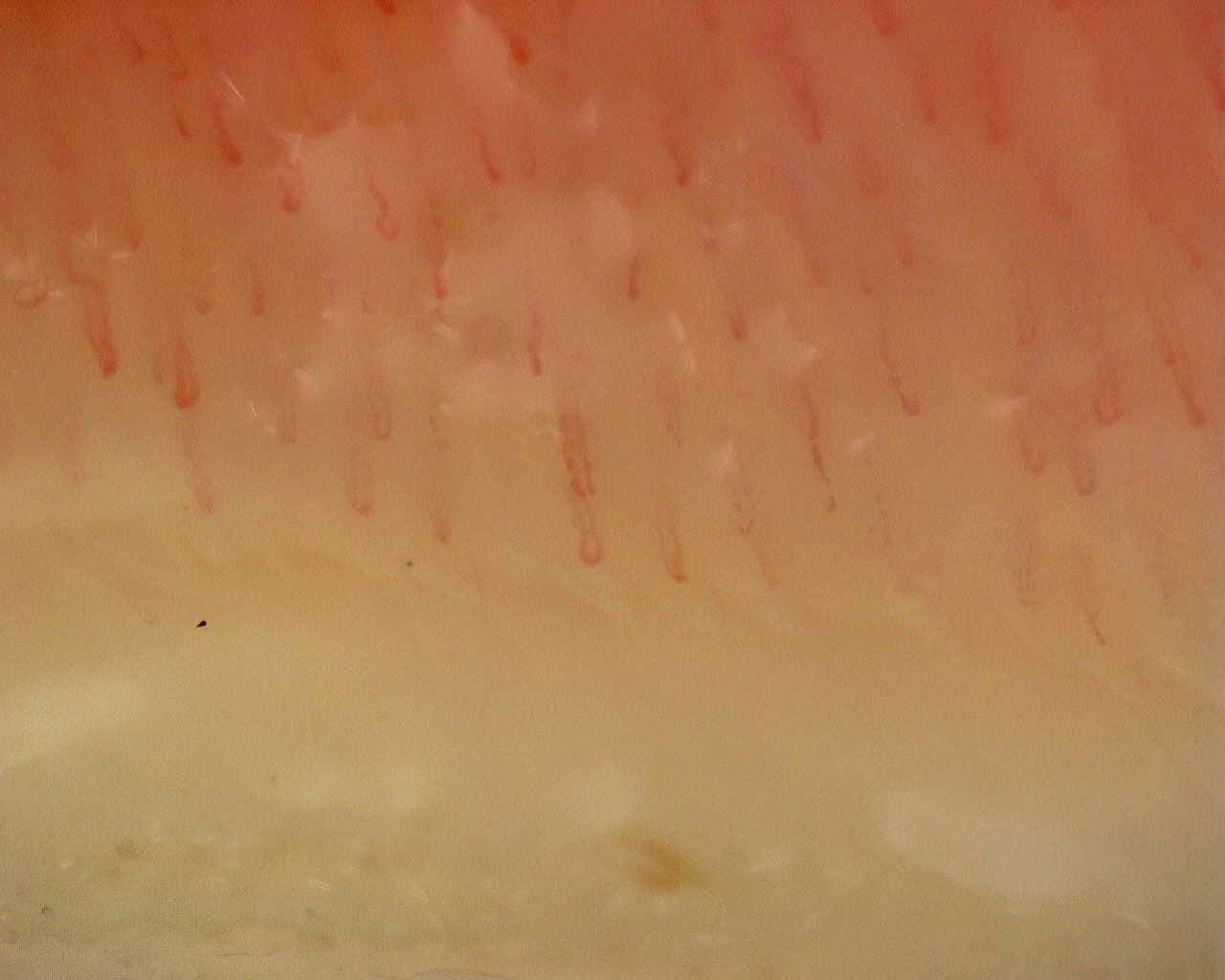Nailfold capillaroscopy: left index finger, field d. Non-Specific Pattern: Representative Case.