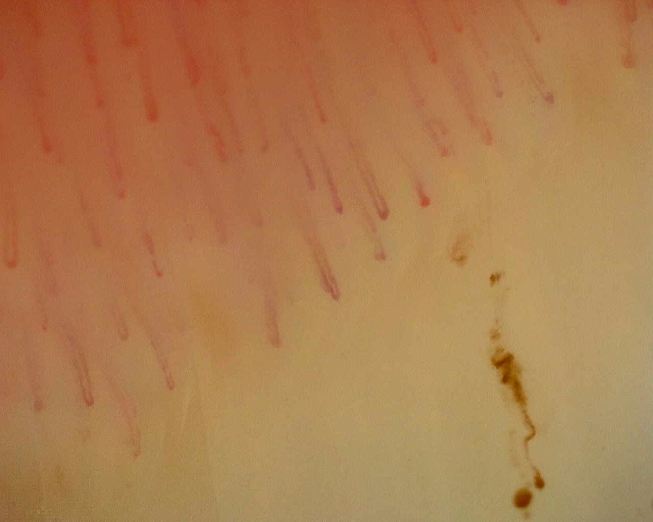 Nailfold capillaroscopy: left middle finger, field a. Non-Specific Pattern: Representative Case.