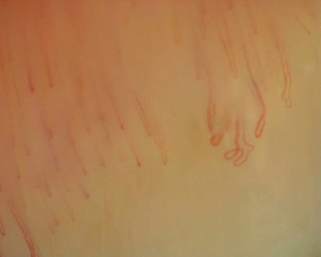 Nailfold capillaroscopy: right ring finger, field d. Non-Specific Pattern: Representative Case.