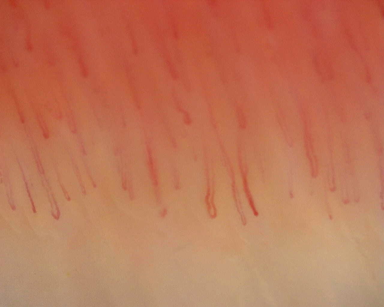 Nailfold capillaroscopy: right little finger, field b. Non-Specific Pattern: Representative Case.