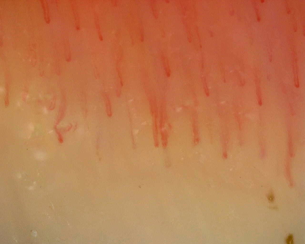 Nailfold capillaroscopy: left middle finger, field d. Non-Specific Pattern: Representative Case.