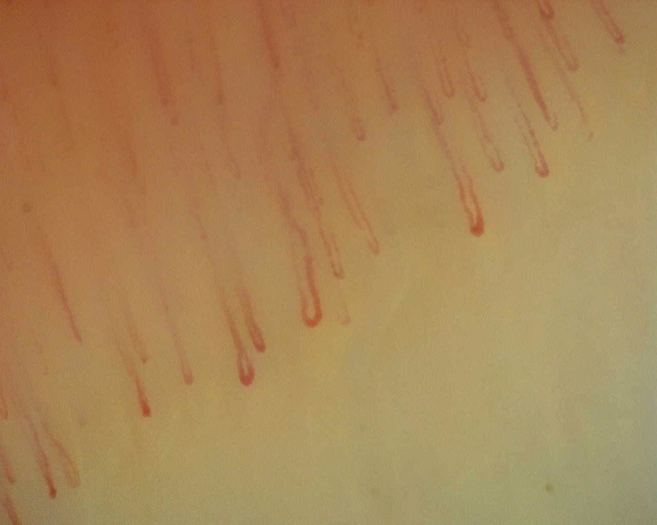 Nailfold capillaroscopy: left ring finger, field a. Non-Specific Pattern: Representative Case.