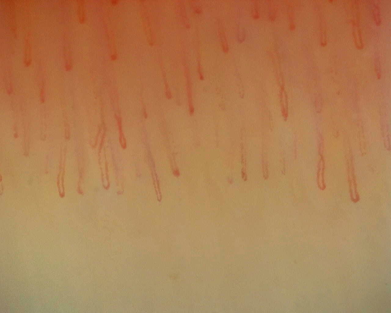 Nailfold capillaroscopy: left ring finger, field c. Non-Specific Pattern: Representative Case.