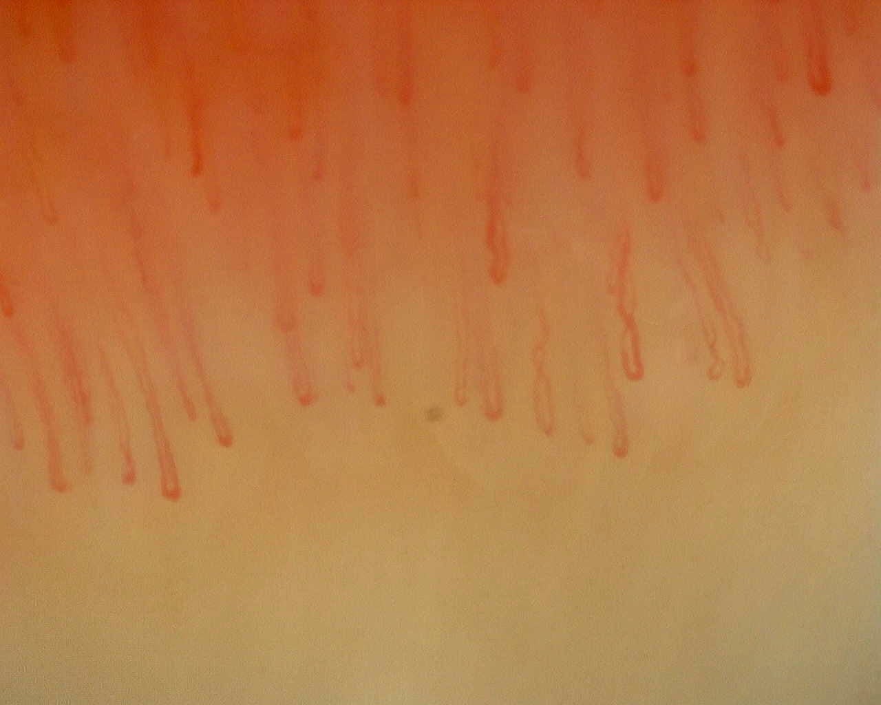Nailfold capillaroscopy: right middle finger, field c. Non-Specific Pattern: Representative Case.