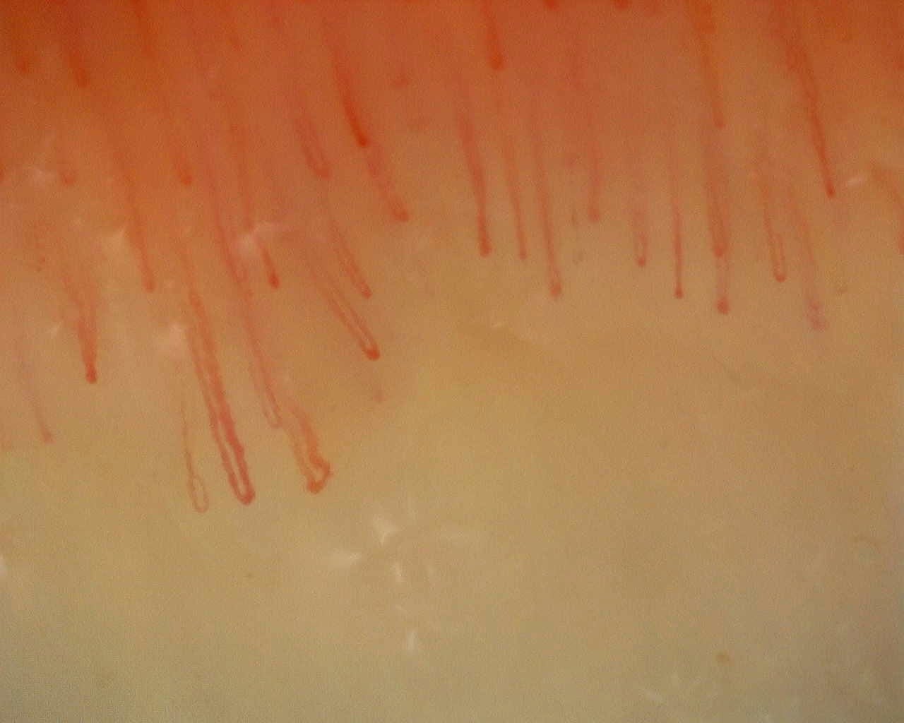Nailfold capillaroscopy: left middle finger, field c. Non-Specific Pattern: Representative Case.