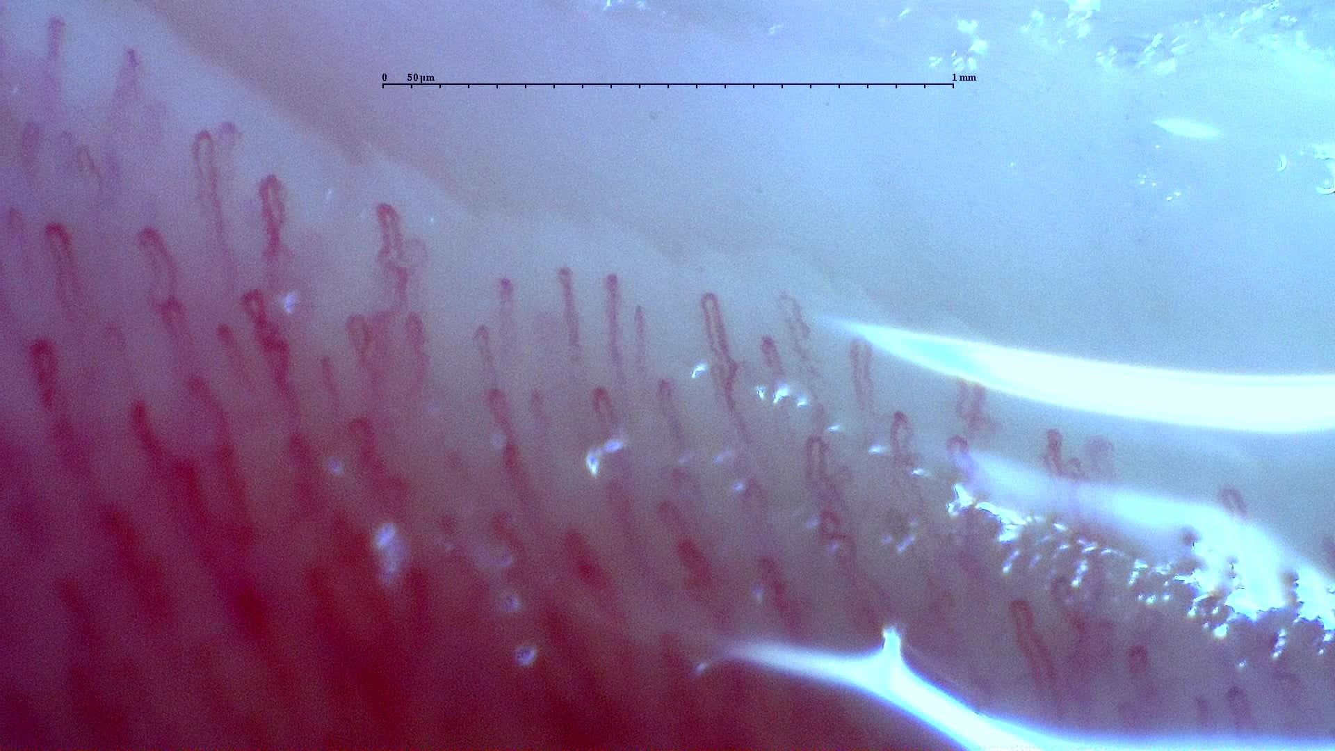 Nailfold capillaroscopy: right middle finger, field a. Normal Pattern: Representative Case.