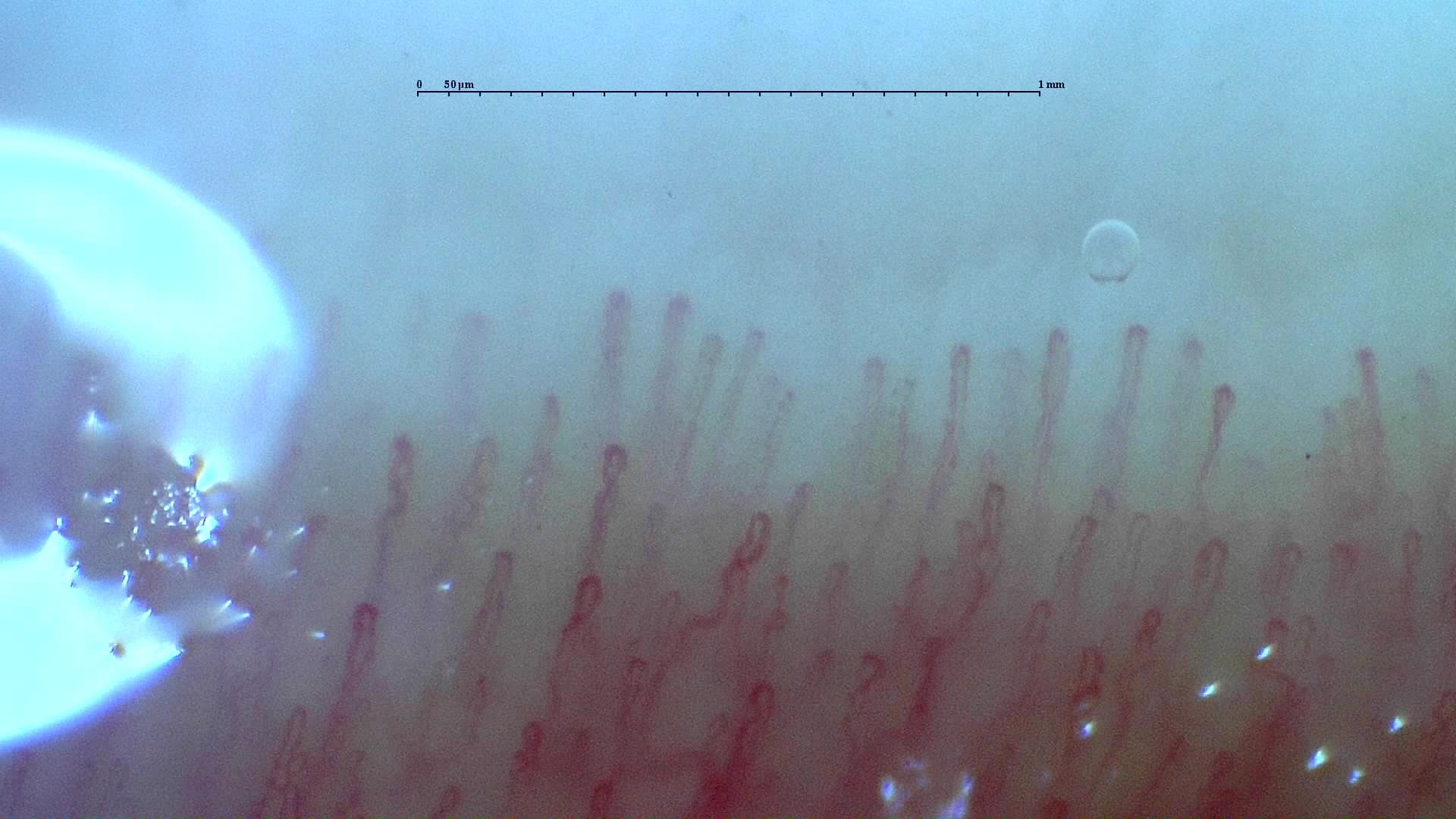 Nailfold capillaroscopy: right middle finger, field c. Normal Pattern: Representative Case.