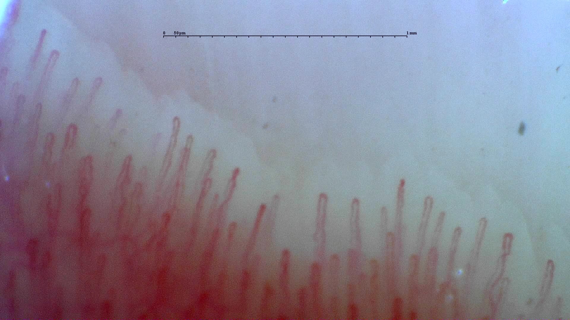 Nailfold capillaroscopy: left index finger, field c. Normal Pattern: Representative Case.