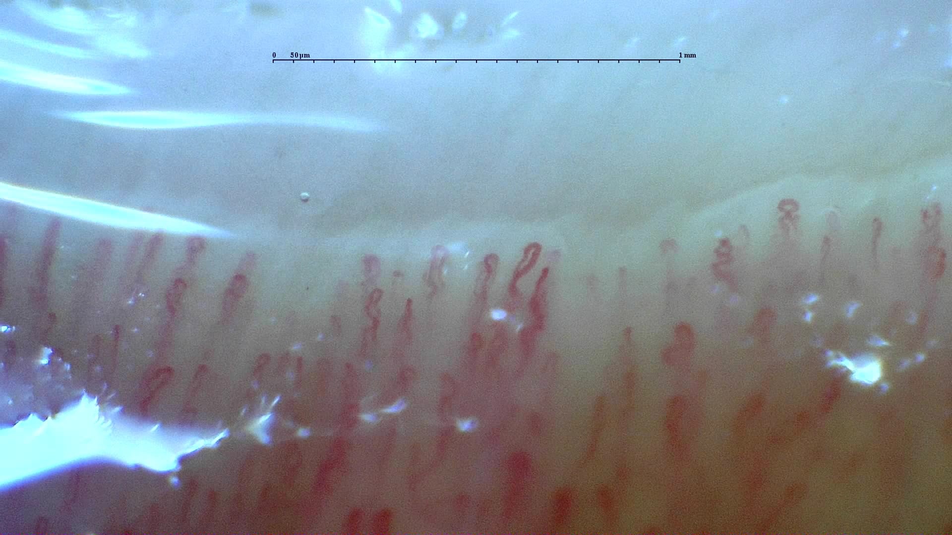 Nailfold capillaroscopy: right index finger, field a. Normal Pattern: Representative Case.