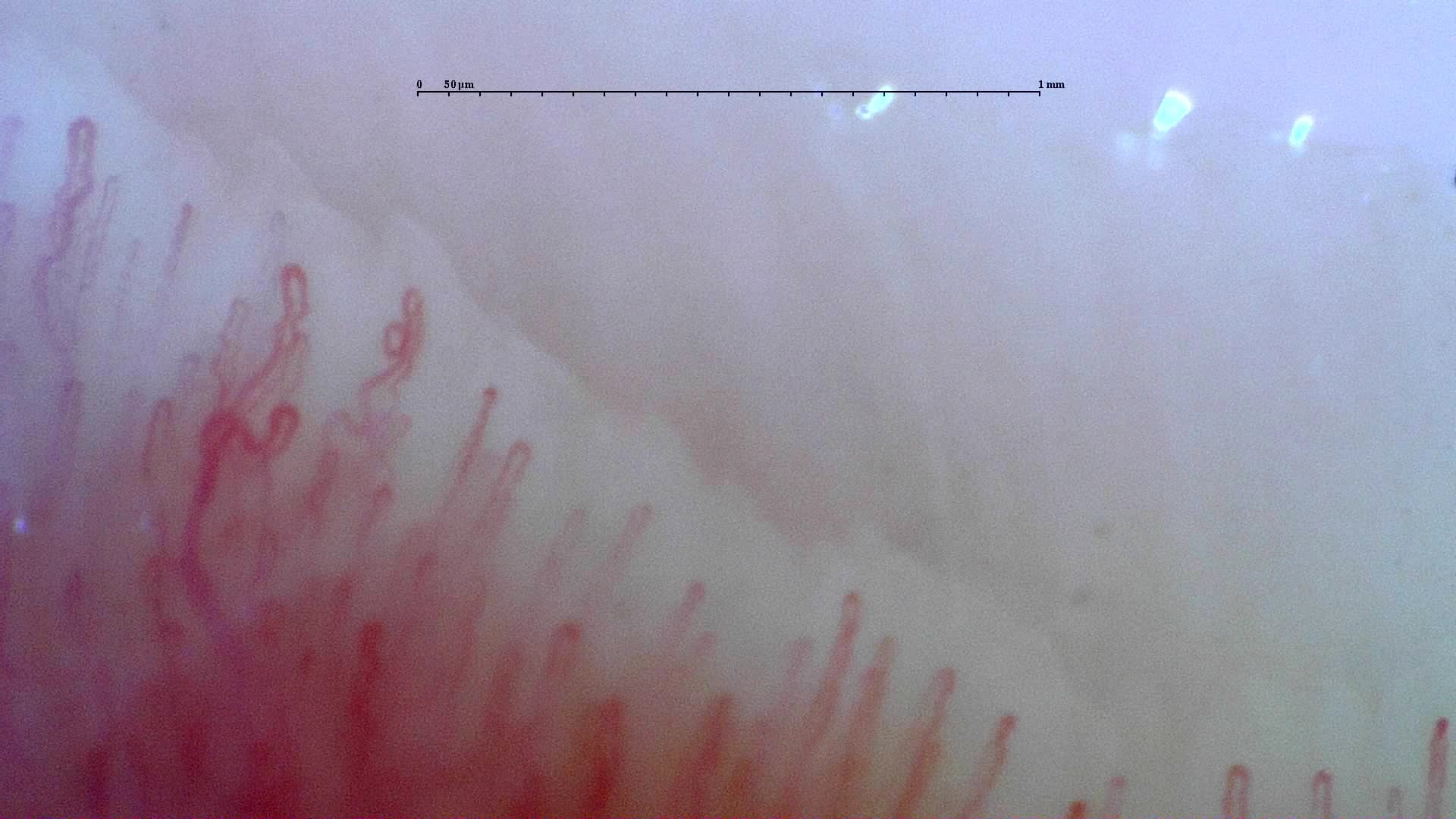 Nailfold capillaroscopy: left index finger, field d. Normal Pattern: Representative Case.