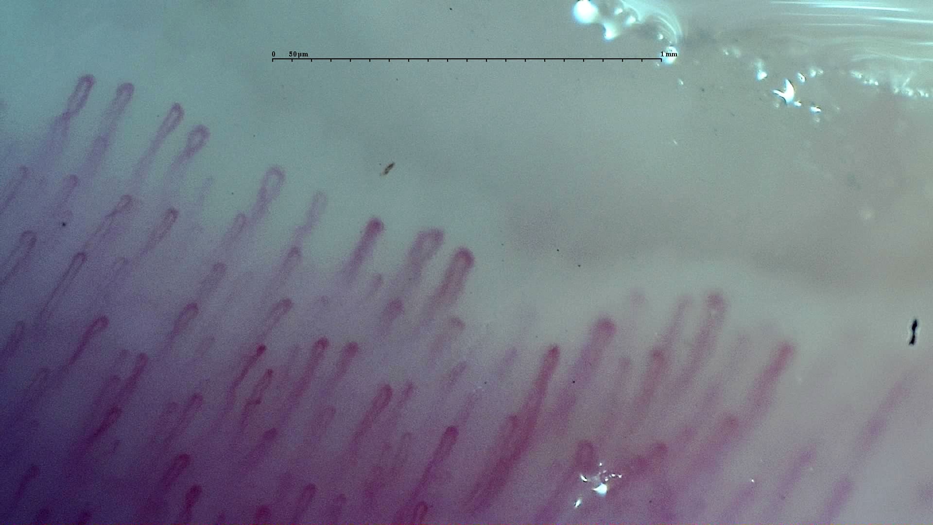 Nailfold capillaroscopy: right index finger, field a. Early SSc Cutolo Pattern: Representative Case.